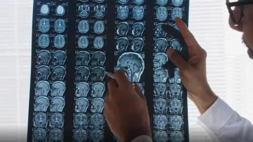 doctors looking at a brain injury